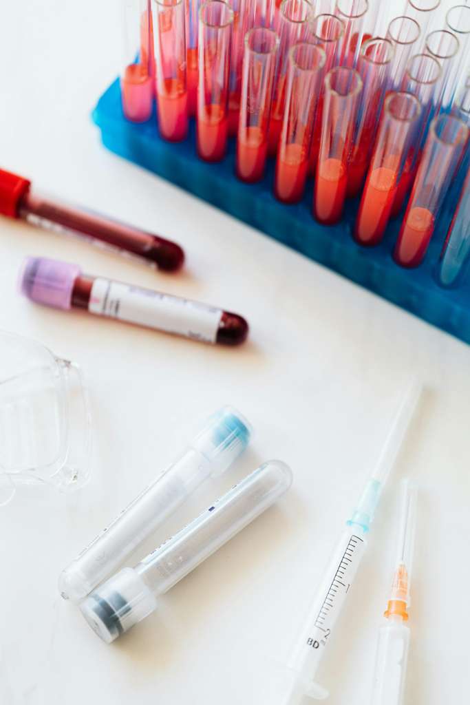 Bloodwork