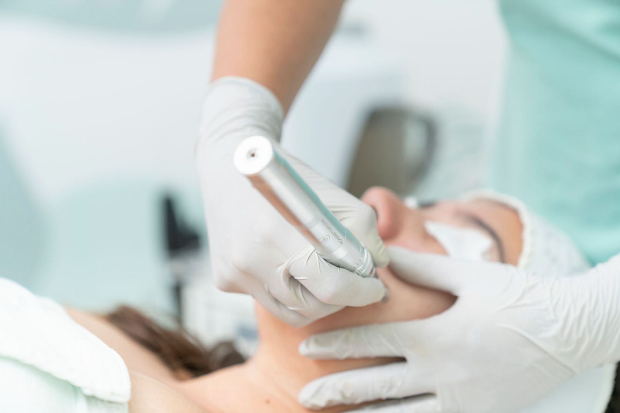 Microneedling with Exosomes